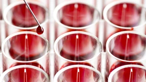 Wie man Krebs bald schon im frühsten Stadium erkennen kann