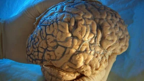 Mein Kopf gehört mir