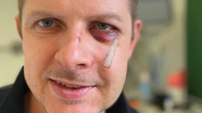 Ecke veröffentlicht Selfie aus dem Krankenhaus