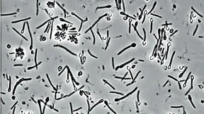 Das Geheimnis der Essigsäurebildner