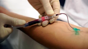 Nada leitet Verfahren für Zeitraum vor 2011 ein