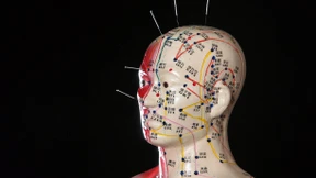 Die Geschichte meiner Kopfschmerzen