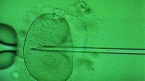 Die Unantastbarkeit der Gene