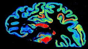 1,7 Milliarden Nervenzellen des Hirns simuliert