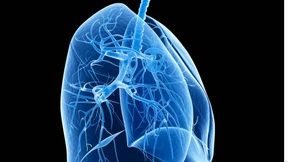 Bringt uns der Diesel um?