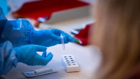 Inzidenz steigt auf 80,7