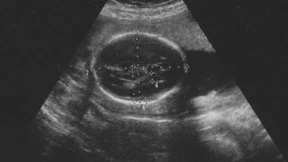 „Schrecklich, so etwas zu denken“