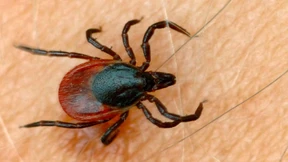 Zeckenbiss ist kein Dienstunfall