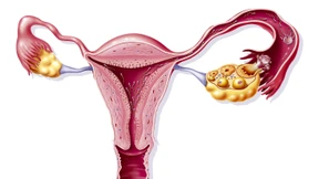 „Was spricht dagegen, Kinderwünsche zu erfüllen?“