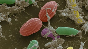 Wie die Darmflora die körpereigene Abwehr aktiviert