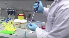 Den Gründen der Covid-19-Langzeitfolgen auf der Spur