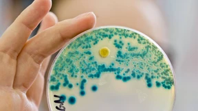 Wenn Antibiotika und Impfstoffe fehlen