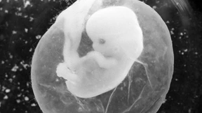 Ärzte sollen über Abtreibungen informieren dürfen