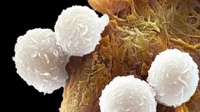 Impfstoffe als Krebstherapie