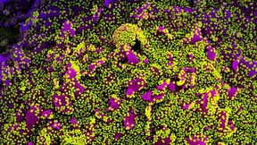 Schwachstelle in Enzym von Coronaviren entdeckt