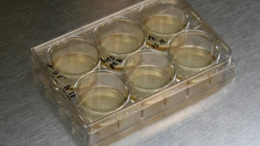 Embryonalzellen werden nicht zum Geschäftsmodell