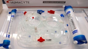 FMC-Aktionäre geben grünes Licht für Trennung von Fresenius