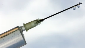 Ein besonders sensibler Bereich