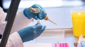 Was ist denn jetzt mit der erweiterten DNA-Analyse?