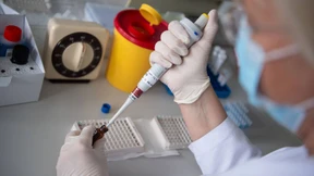 Was bringen Antikörpertests?