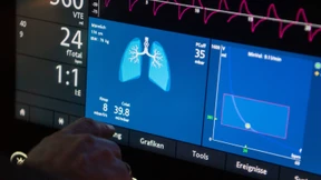 Uni-Team entwickelt neue Beatmungsgeräte