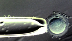 Ist es ein Mensch, ein Embryo?