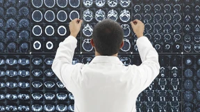 Sind Algorithmen tatsächlich die besseren Ärzte?