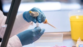 Bayern und Baden-Württemberg drängen auf Erweiterung der DNA-Analyse