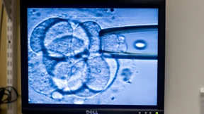 Gentests an Embryonen bald in Ausnahmefällen erlaubt