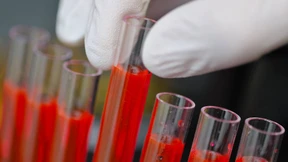 Biotechkonzern kauft Krebsspezialisten für 9 Milliarden Dollar