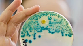 Ärzte verordnen zu viele „Notnagel-Antibiotika“