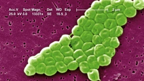 Die Waffen eines Krankenhauskeims identifiziert