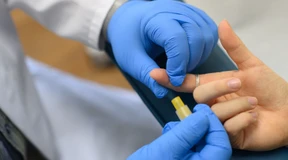 Zahl der HIV-Fälle 2022 leicht gestiegen