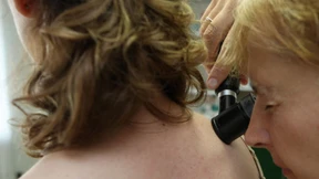 Bedenkliche Muttermale  