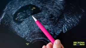 Mutterschutz gilt jetzt auch bei Fehlgeburten