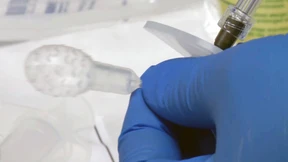 Ballons in der Speiseröhre