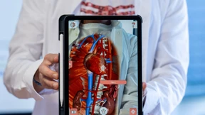 WLAN und iPads für alle