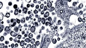 Frankfurter Lassa-Patient geheilt entlassen