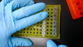 40.000 neue HIV-Infizierte in China