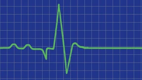 Gemordet wird nach Schema F