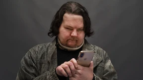 Joe DiMeo hat wieder Gesicht und Hände