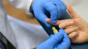 Fortschritte bei der Bekämpfung von HIV und Aids sind massiv gefährdet