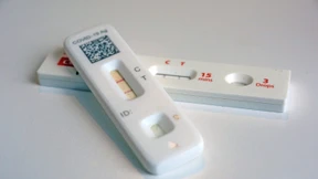 Uni Mainz erprobt Verhaltenstherapie gegen Post-Covid-Syndrom