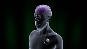 Stromstöße gegen die Sucht