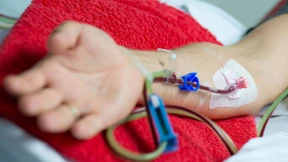 Ein Wattestäbchen gegen den Blutkrebs