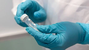 Neuer Rekord bei Corona-Fällen in Hessen