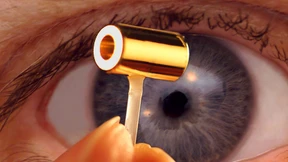 Das Sonnenfeuer im Pfefferkörnchen