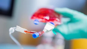 Am Anfang war das Wort