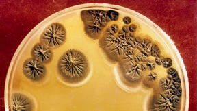 Das globale Antibiotika-Desaster 