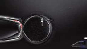 Gesetzesfrust um Embryonen und Gene 